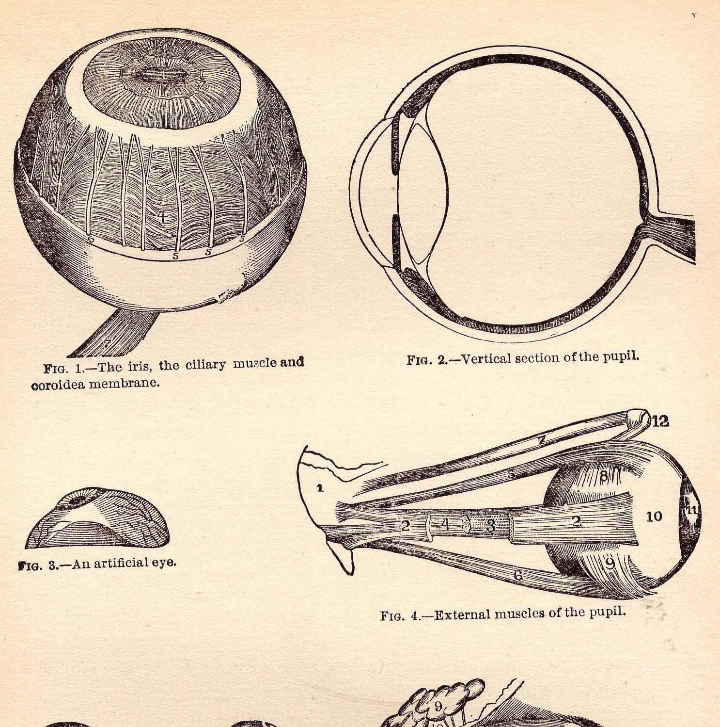 Old Medical Diagram