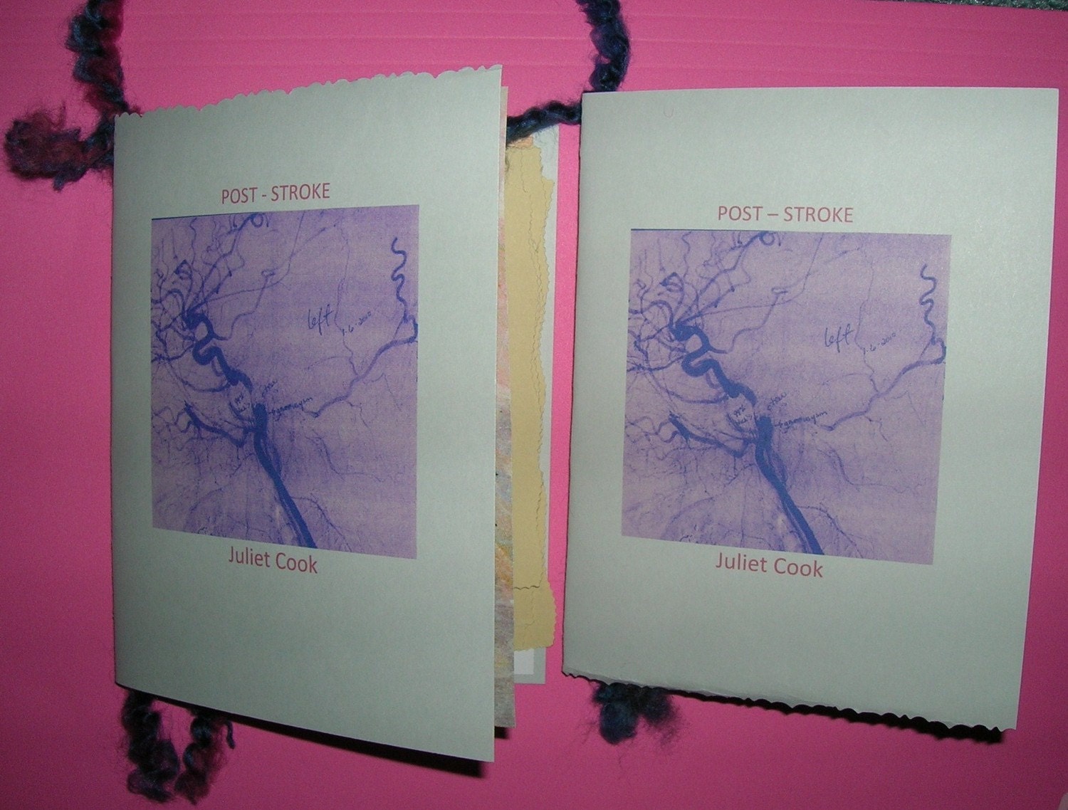 POST STROKE by Juliet Cook
