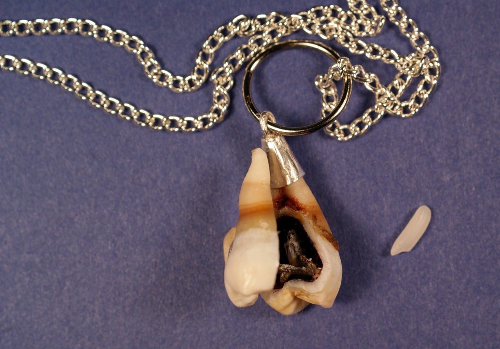 Tooth Locket - The Wisdom Tooth