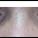 Bright Eyes Organic Dark Under Eye Circle Cream with Haloxyl and Soy Peptides - 1 oz No Parabens