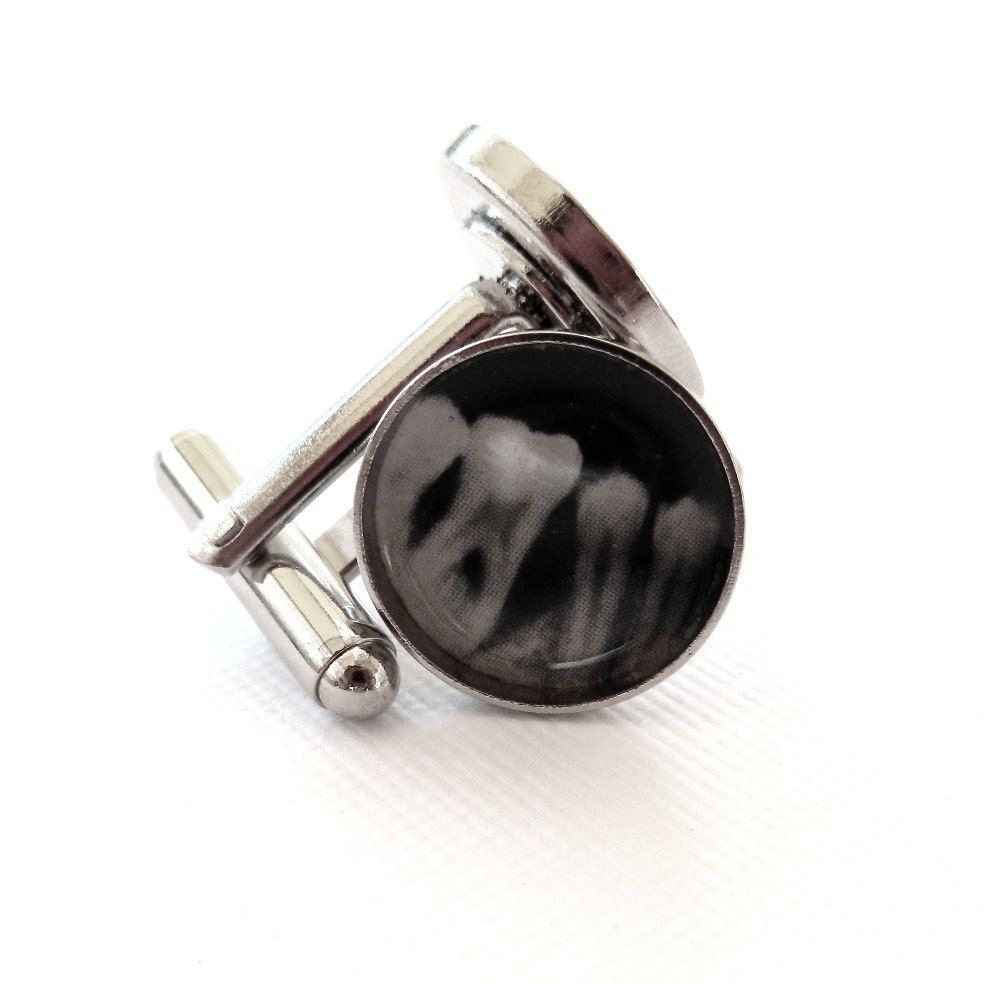 Perio PA Dental X-Ray Cuff-links