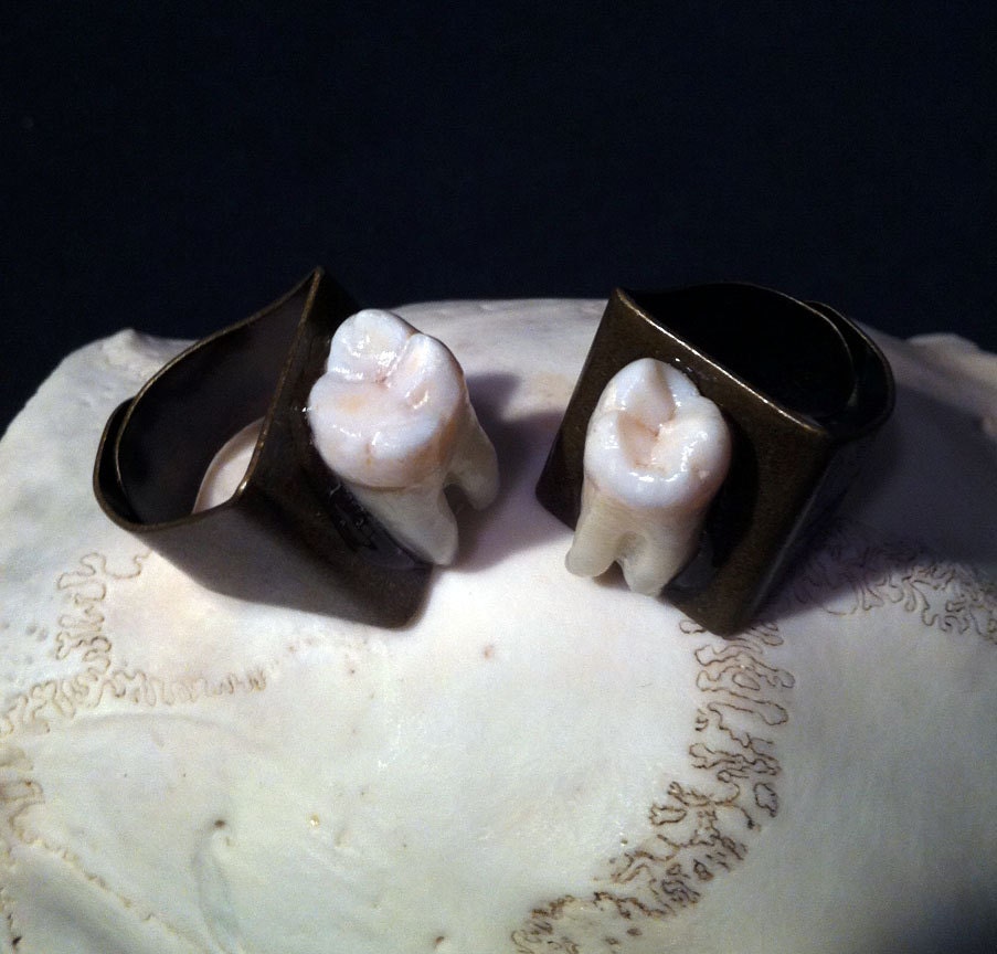 PRE-ORDER - Tooth Fairy Series: Chunky Style Adjustable Ring with Whole Real Human Molar in Silver or Antique Brass