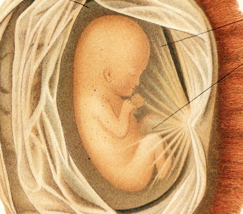 1897 Bizarre victorian  FETUS litograph, fetal development from the ovule, embryo, original antique 115 years old amazing print