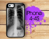 iPhone 4 4S Mighty Case - 2 Part Protective iPhone 4 Case  iPhone 4S Case - XRay Chest x Ray Medical Chart