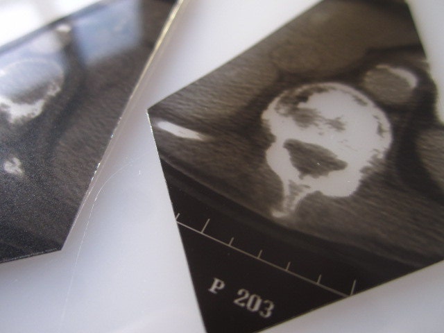 Last Breath Upcycled Vertebrae Skeleton X-Ray Earrings