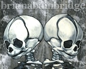 Mini twin fetal skeletons. Signed print