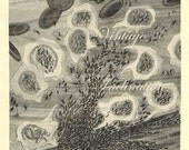 Antique Medical Print, The White Cells,  microscope view of blood cells anatomy anatomical microscopic scientific science