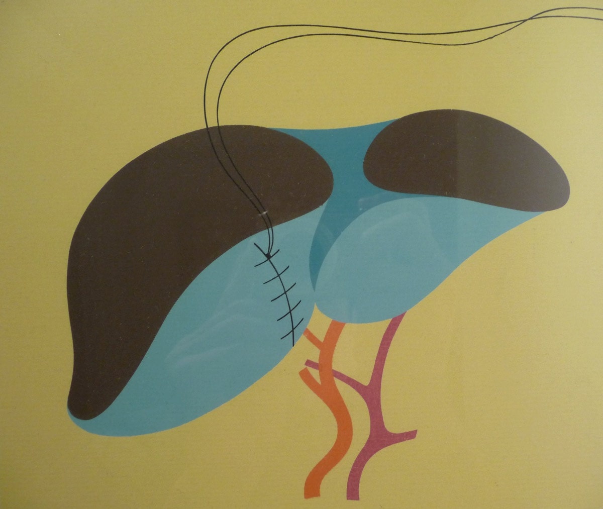Mid-Century Medical Serigraph Silkscreen Pop Art Eames Era Space Age Modern