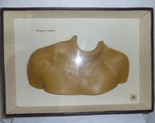 Antique Wax Medical Chest Piece from the Deutsches Hygiene Museum Dresden - Shadowbox Framed - Disease Study
